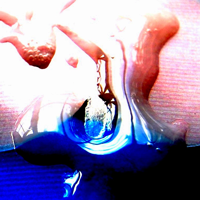 hett witedski anchor